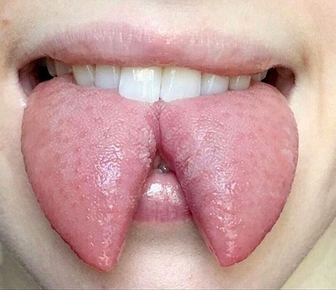 스플릿 텅 관련 이미지 2