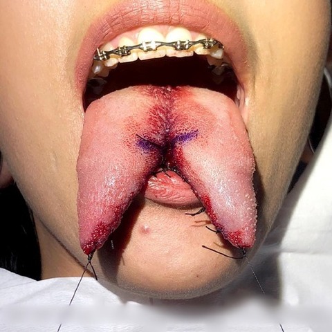 舌头分裂相关图片 8