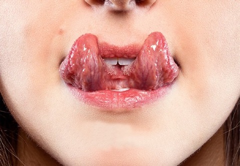 舌头分裂相关图片 9
